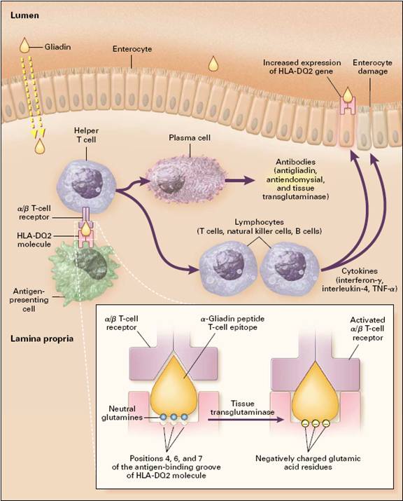 High Antibodies Celiac at Cameron Blake blog